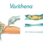Veins, Disease & Treatments For Both Superficial Veins And Deep Venus System Are Important!, Vein Specialists of the Carolinas Varisolve: An Old Name for a New Treatment