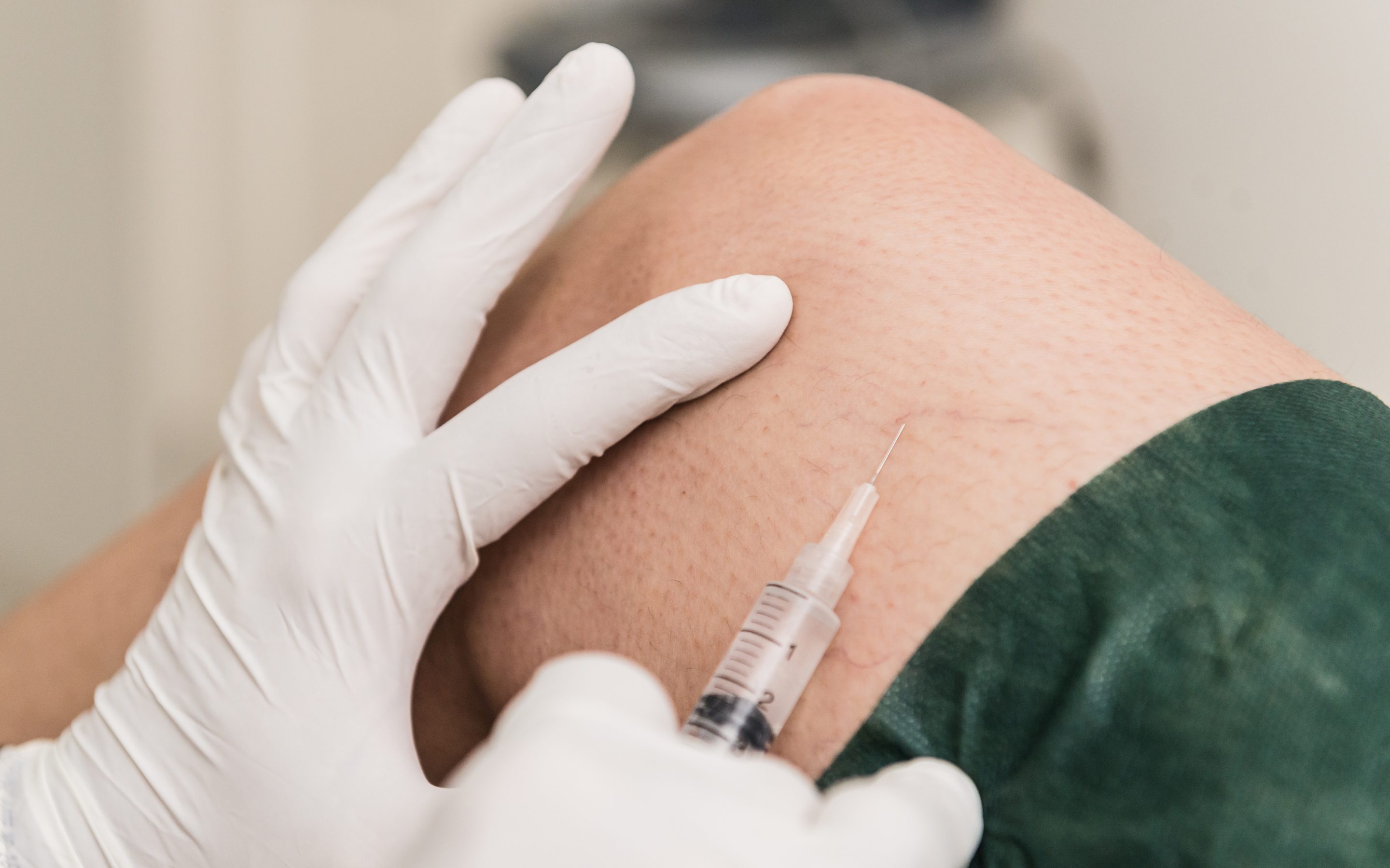 Sclerotherapy, treatment to remove microvarices