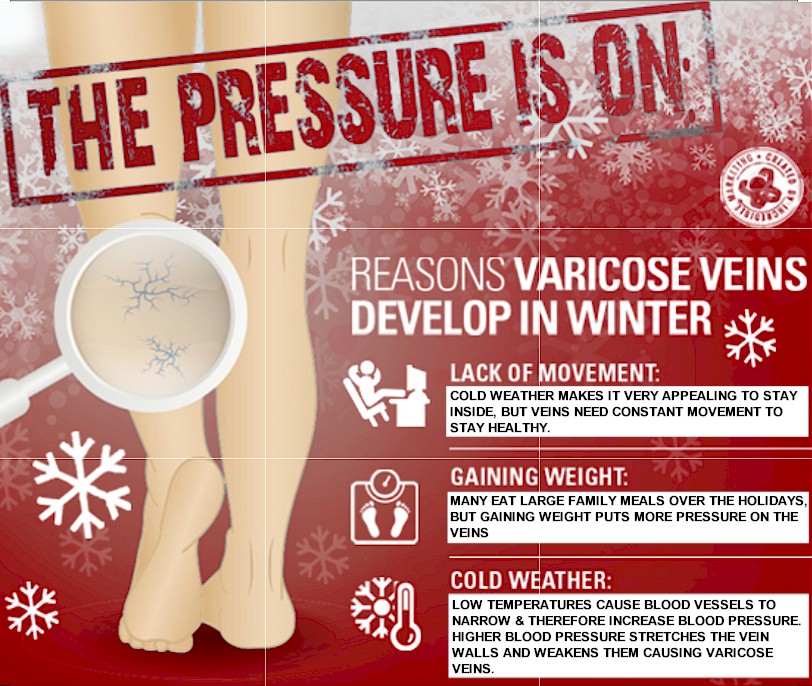 The Pressure is On! Speaking of Varicose Veins…