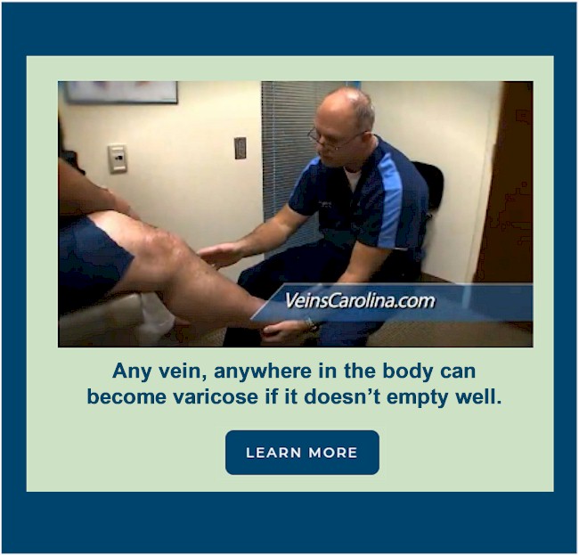 What to Expect from Your Vein Evaluation