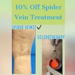 The Reality of Castor Oil for Varicose Veins, Vein Specialists of the Carolinas VSC is offering 10% off all Cosmetic Spider Vein Treatments during the month of June!