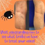 Got Spider Veins?, Vein Specialists of the Carolinas spooky_spider_veins