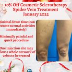 Start the new year off with vein free, beautiful legs