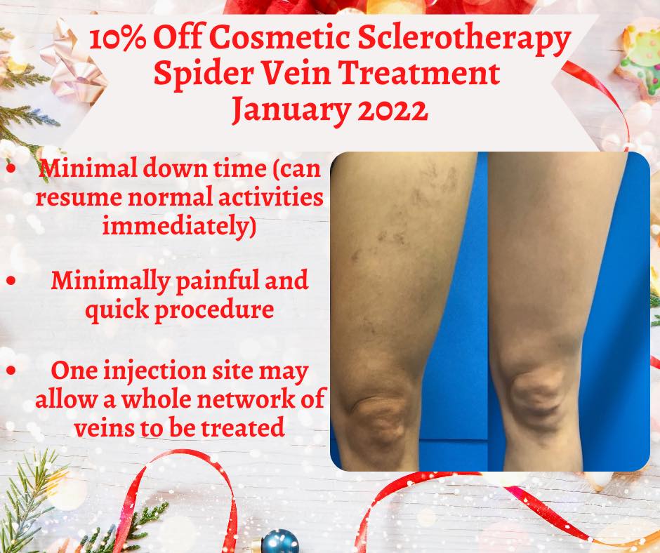 Start the new year off with vein free, beautiful legs!