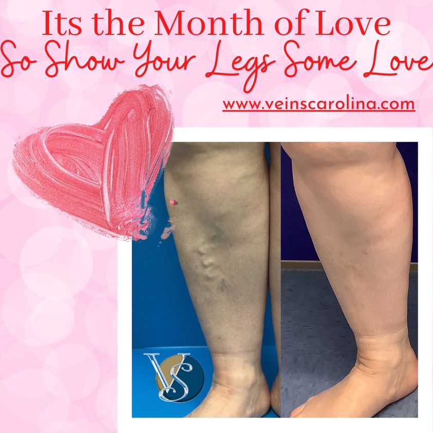 Show Your Legs Some Love