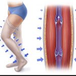 the effects and benefits of medical compression