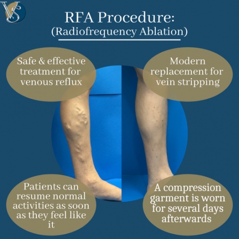rfa procedure icd 10