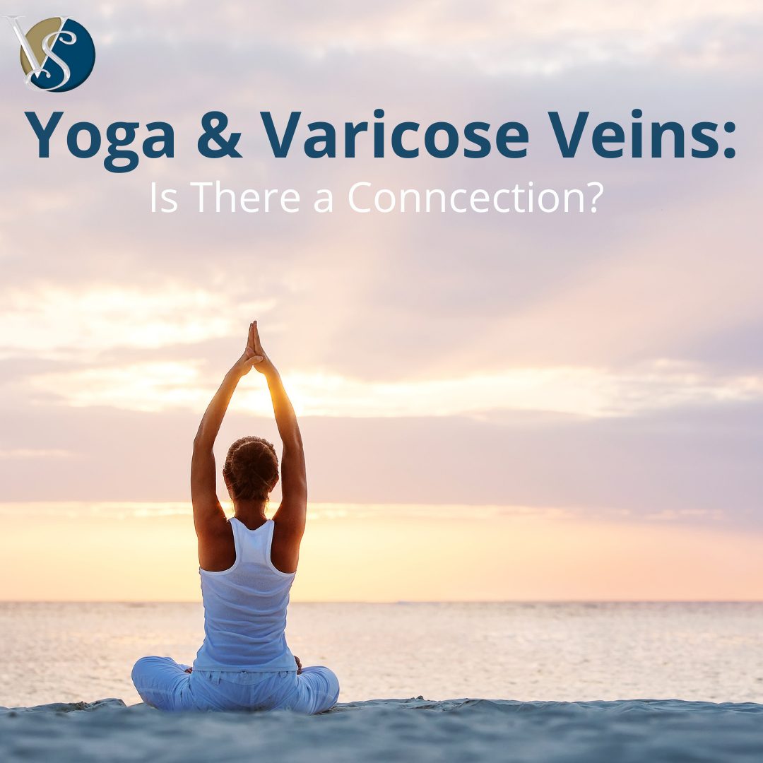 Yoga and Varicose Veins: Is there a Connection?