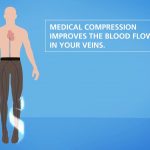 Understanding DVT and The Symptoms, Vein Specialists of the Carolinas medical compression improves blood flow in your veins