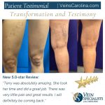 VSC is offering 10% off all Cosmetic Spider Vein Treatments during the month of June!, Vein Specialists of the Carolinas Transformation AND Testimonial Thursday - Sclerotherapy!
