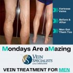 Spider Veins or Varicose Veins: What is the Difference?, Vein Specialists of the Carolinas Make Your Monday Amazing – Men’s Vein Treatment