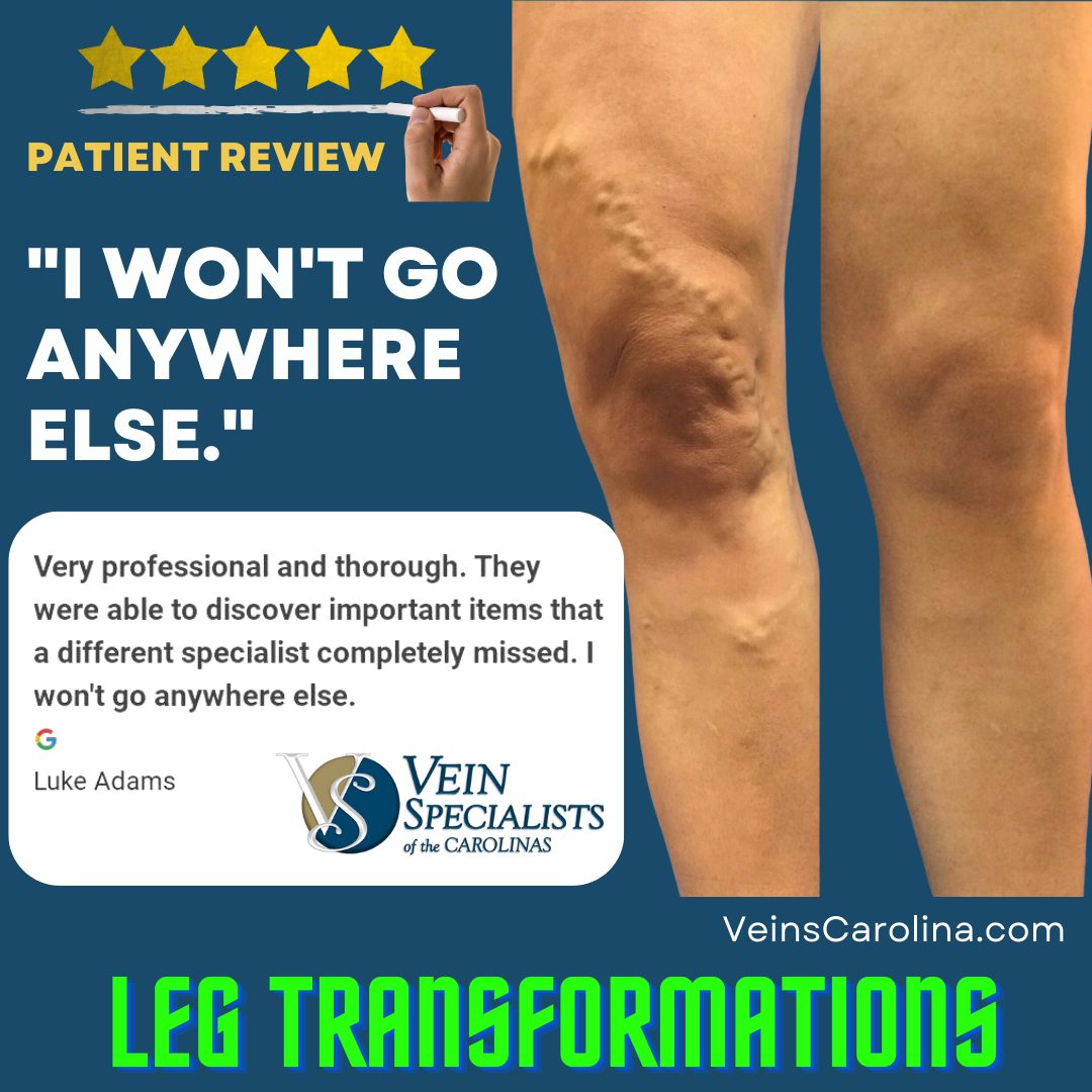 Finally Friday! Our leg transformations look good on women AND men.