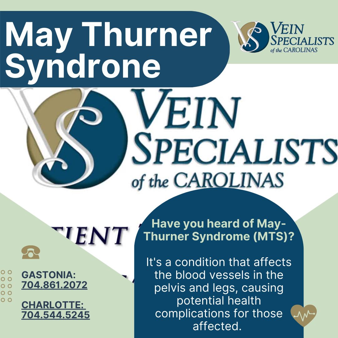 Shedding Light on May-Thurner Syndrome