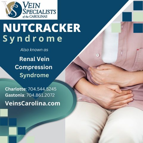 Nutcracker Syndrome...Know The Symptoms - Vein Specialists of the Carolinas