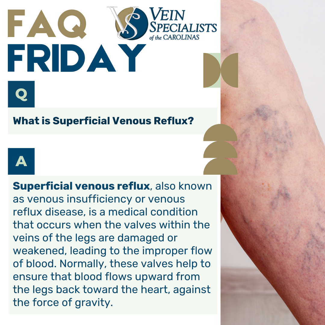 FAQ Friday: What is Superficial Venous Reflux?