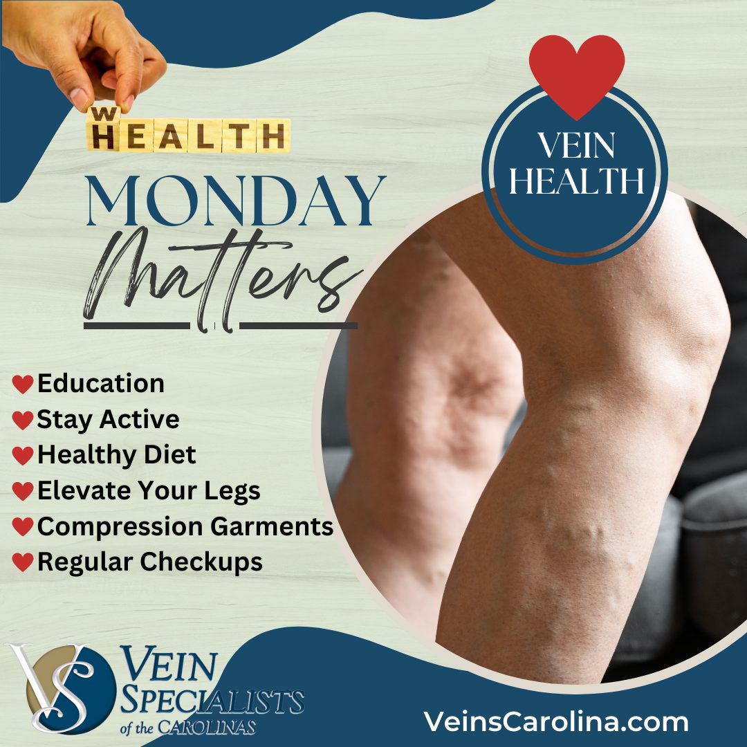 Monday Matters - Your Vein Health!