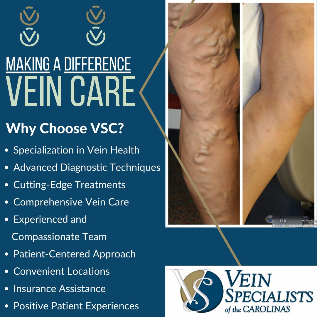 Vein Specialists of the Carolinas - Your TRUSTED PARTNER In Vein Care.