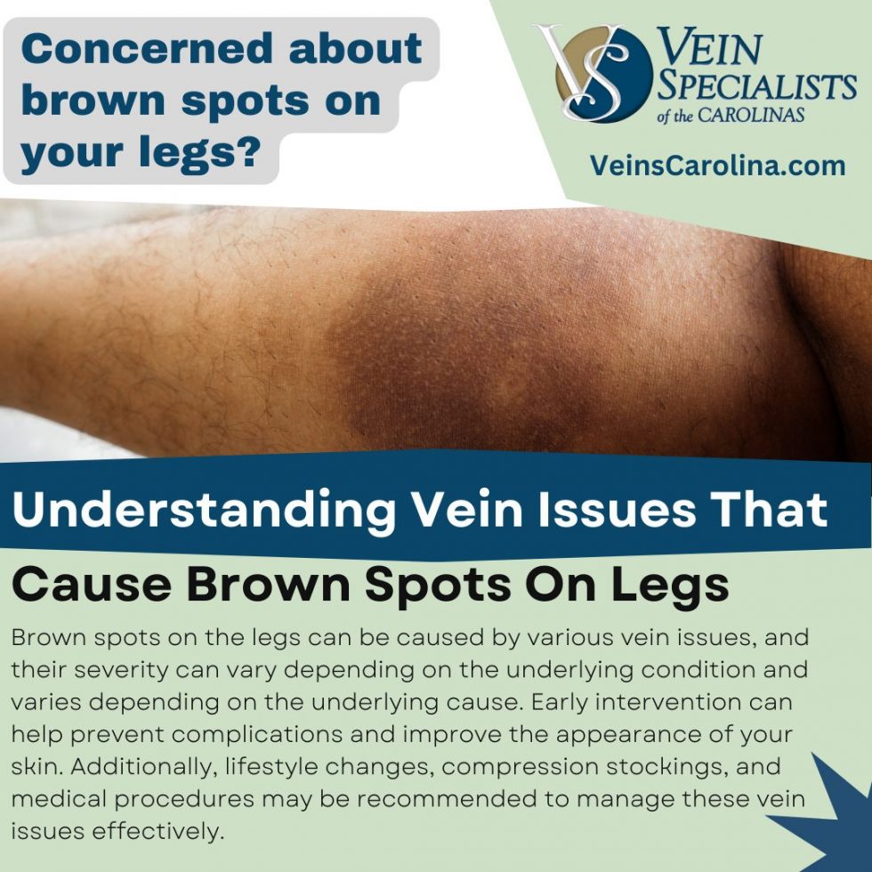 5 Vein Conditions That Cause Brown Spots On Legs - Vein Specialists of ...