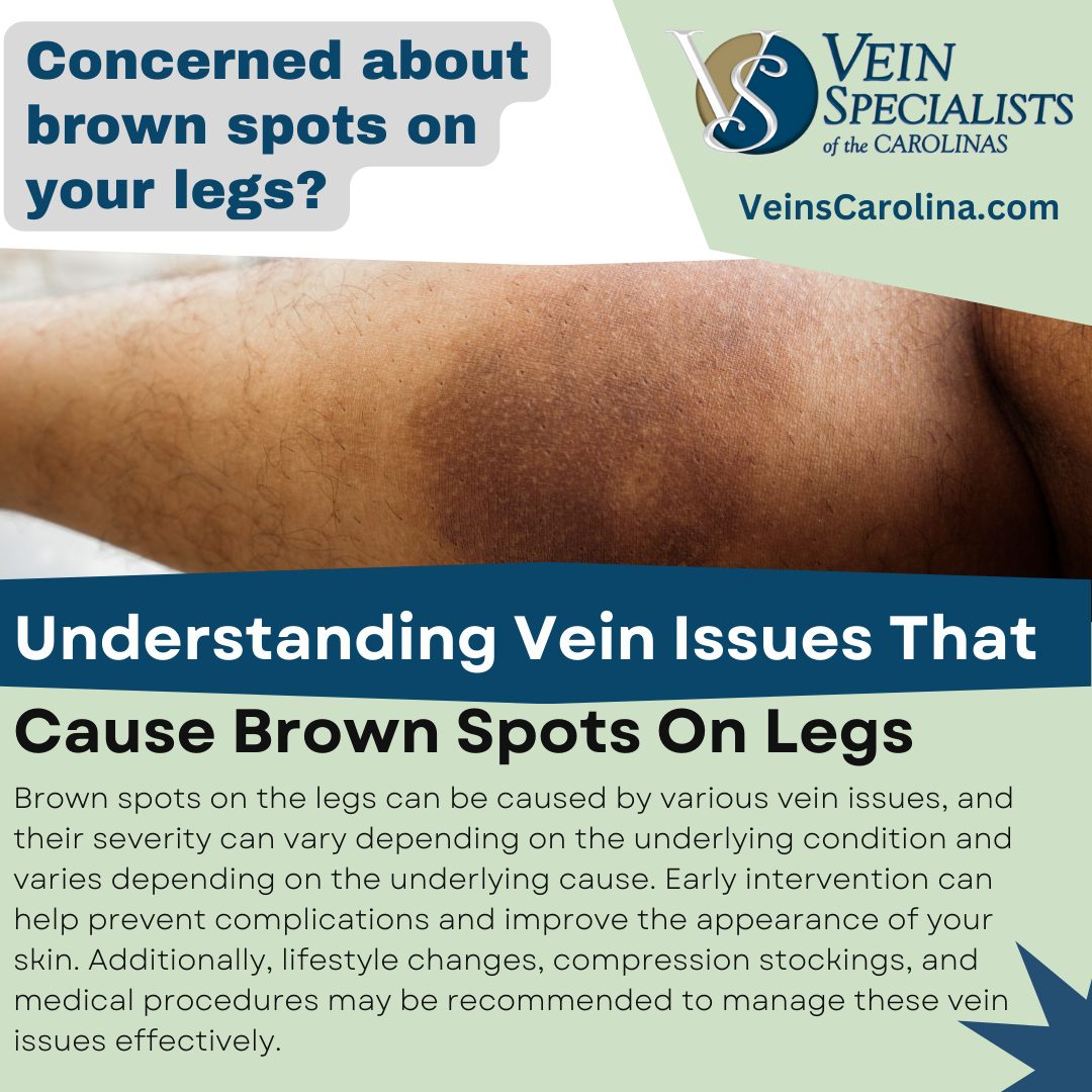 Vein Issues That Cause Brown Spots On Legs