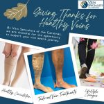 Is it time for you to take a step toward healthy legs?, Vein Specialists of the Carolinas Embracing Gratitude for Healthy Veins: A Thanksgiving Message from Vein Specialists of the Carolinas