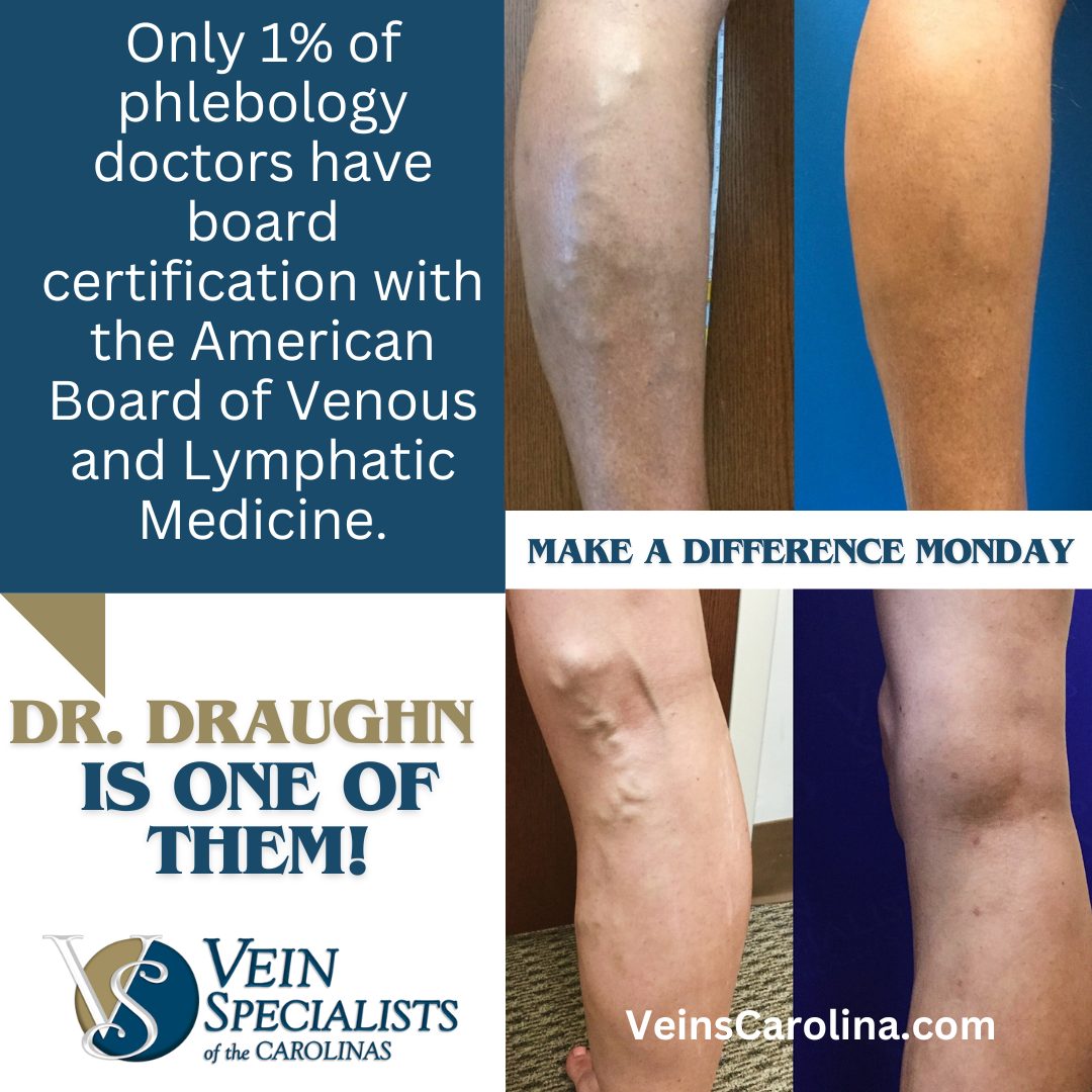 Make a Difference Monday: Vein Care with Board-Certified Expertise and Leadership