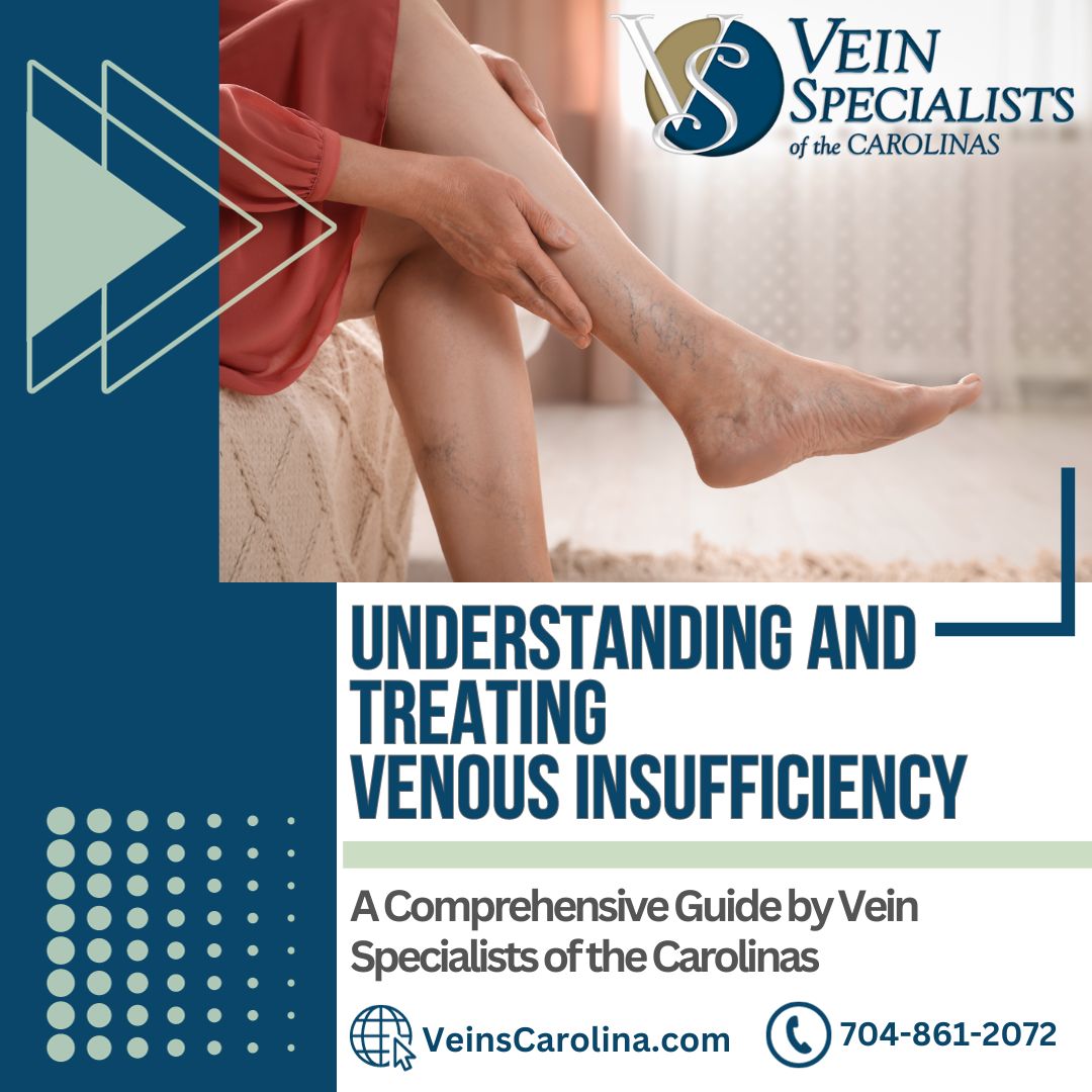 Understanding and Treating Venous Insufficiency: A Comprehensive Guide by Vein Specialists of the Carolinas