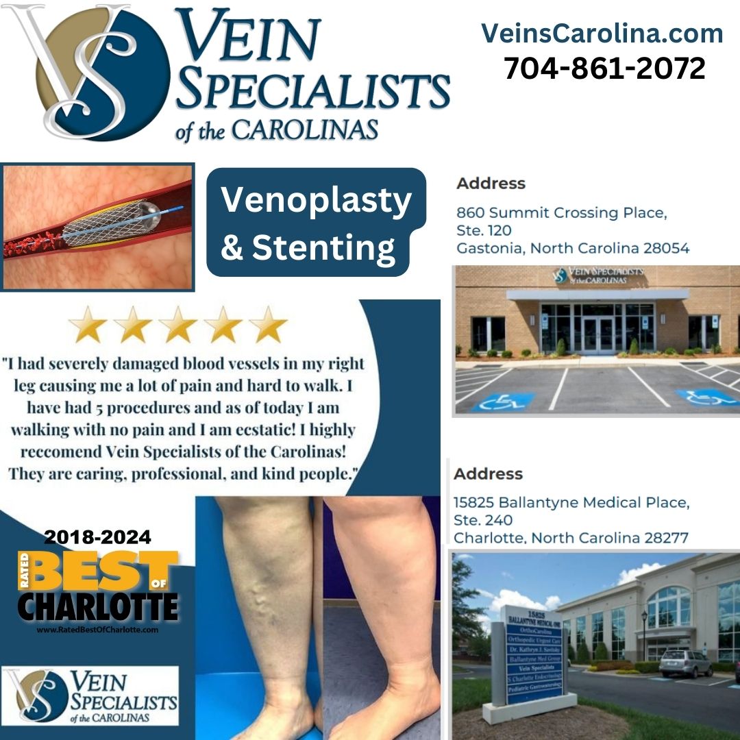 Venoplasty and Stenting - Groundbreaking Procedure for Vein Conditions