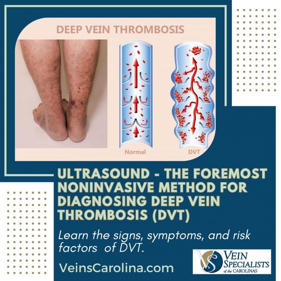 Ultrasound Diagnosing Deep Vein Thrombosis Dvt Vsc