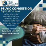 Pelvic Congestion Syndrome (PCS): Shedding Light on a Misunderstood Condition