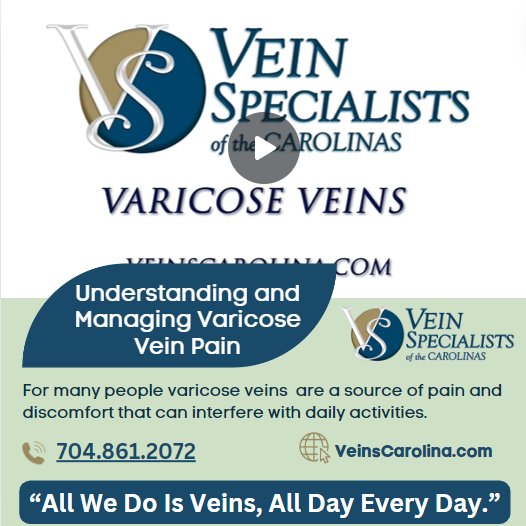 Understanding and Managing Varicose Vein Pain