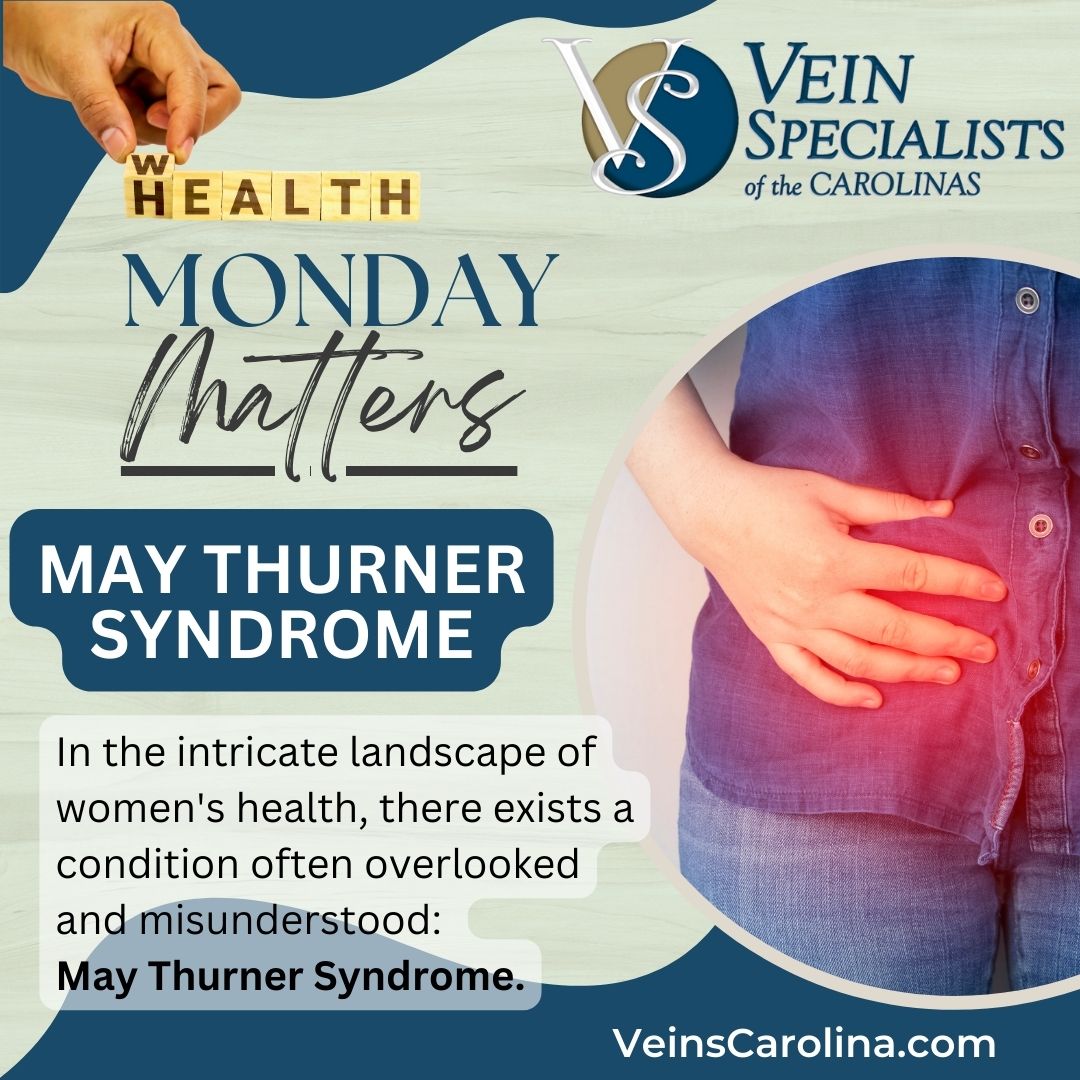 Empowering Women's Health: Conquering May Thurner Syndrome