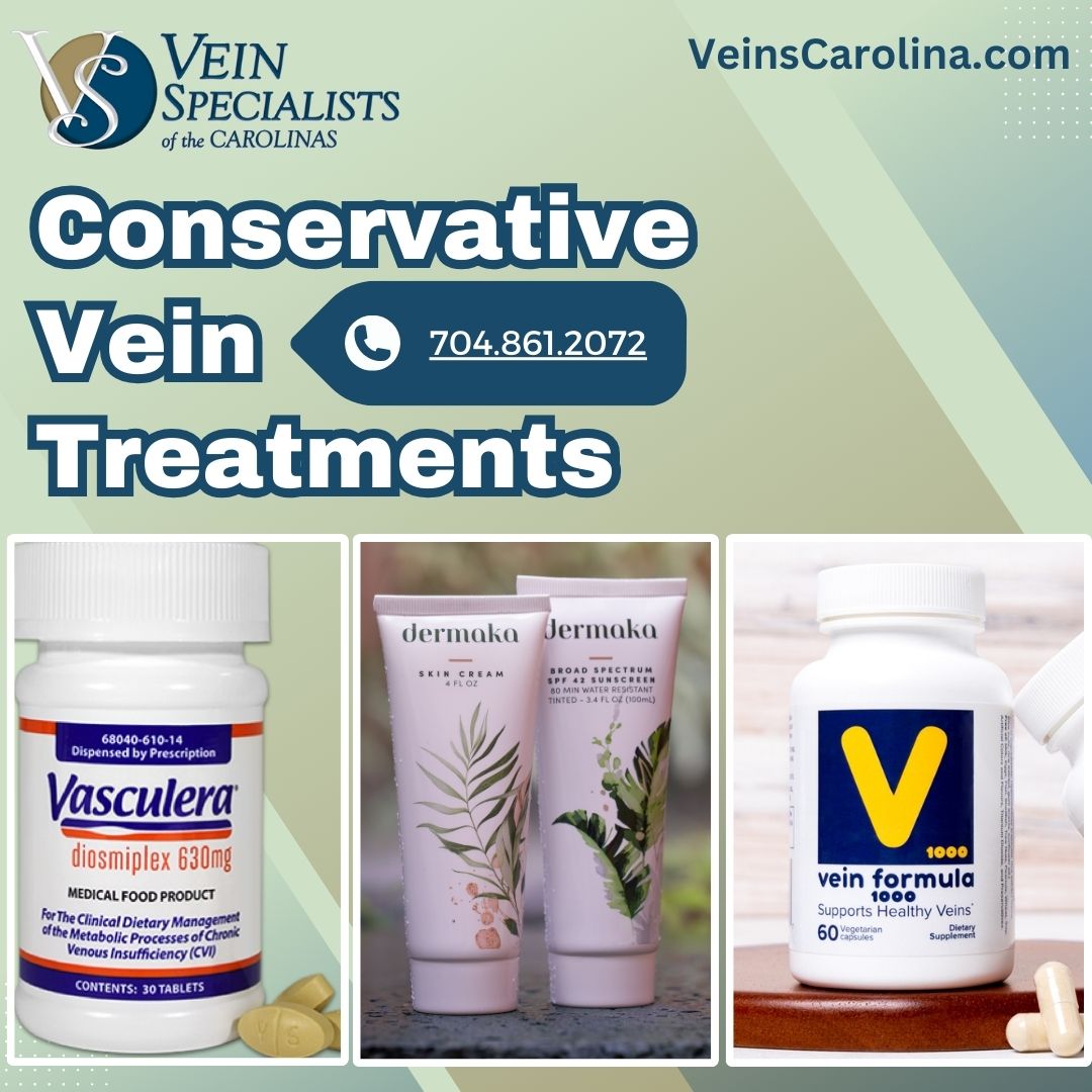 Conservative Treatment Options for Vein Conditions